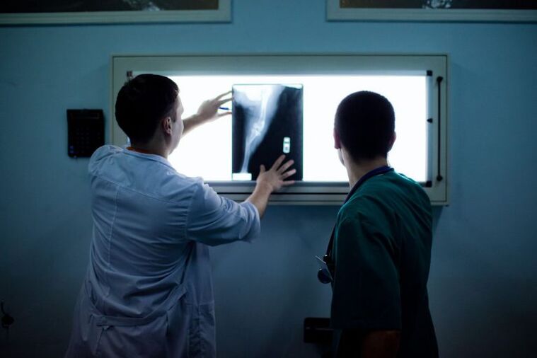 Az ízületi diagnosztizálása az X -Gy -n