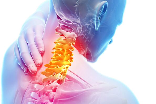 Nyaki osteochondrosis