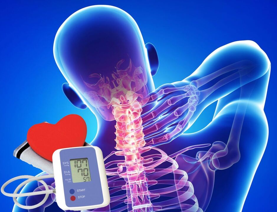 Vérnyomás ugrások nyaki osteochondrosissal